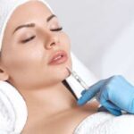 Lip Fillers