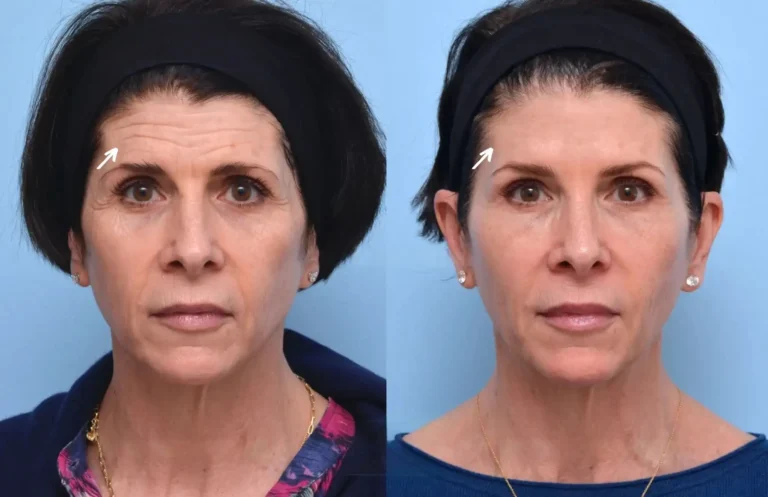Best Aesthetic Clinics in Dubai for Botox Why You Should Trust Experts for Your Cosmetic Needs