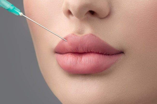 RUSSIAN LI P FILLERS (1)