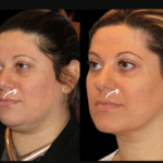 https://www.perfectdrs.com