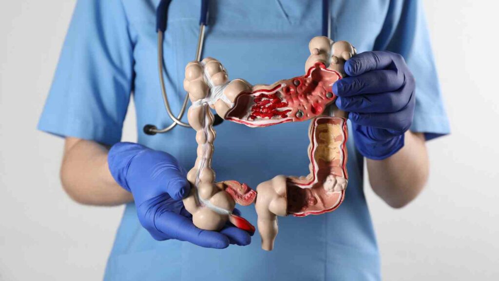 Top 5 Digestive Issues You Can Treat Through Online Consultation