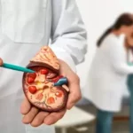 Kidney Stone Doctor in Jaipur