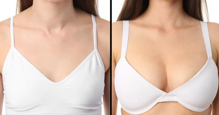 Breast Augmentation in Dubai: The Truth About Recovery and Downtime