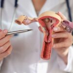 Gynecologist in Malaysia