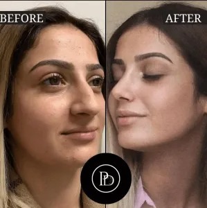 Best Aesthetics Clinic in Dubai