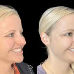 Where to Find the Best Aesthetic Clinics in Dubai for Botox