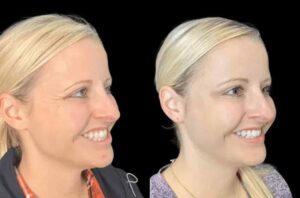 Where to Find the Best Aesthetic Clinics in Dubai for Botox