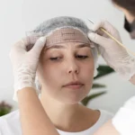 eyebrow transplant antalya