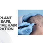 hair transplant clinic