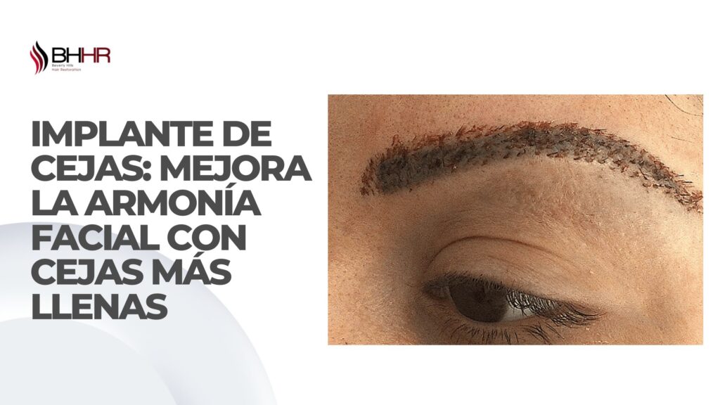 implante de cejas