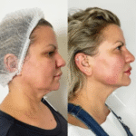 Best Plastic Surgeons in Dubai for Laser and Advanced Treatments