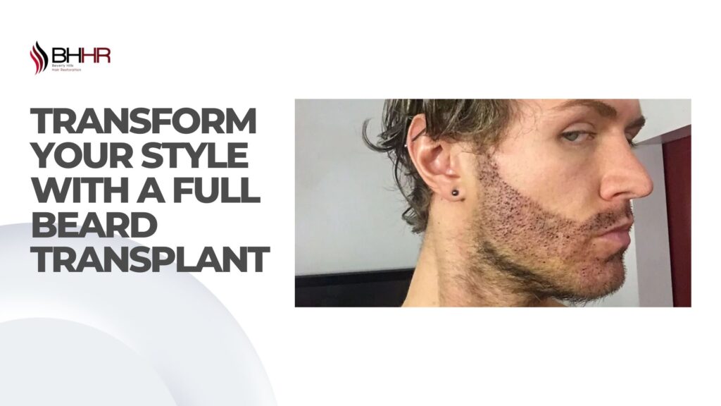 full beard transplant