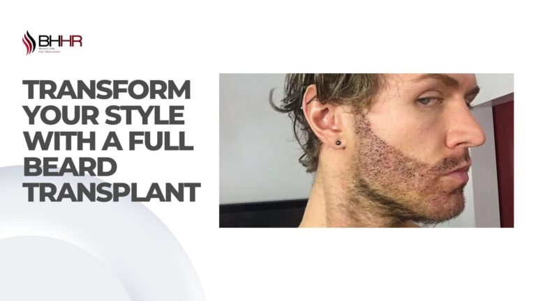 full beard transplant