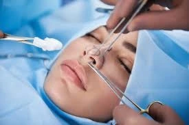 جراحة تجميل الأنف