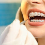 braces for adults in Aberdeen