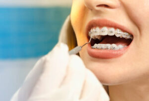 braces for adults in Aberdeen