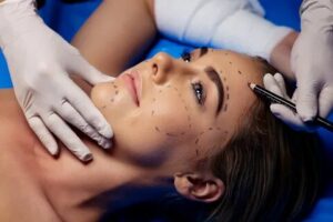 plastic surgery dr matteo