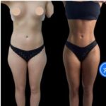 Best Plastic Surgeon in Dubai for Safe and Natural Transform