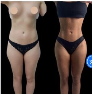 Best Plastic Surgeon in Dubai for Safe and Natural Transform