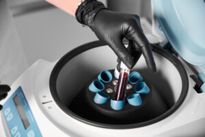 benchtop centrifuge