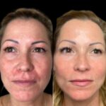 Best Aesthetic Clinic in dubai