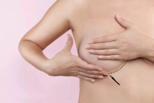 Breast Lift In Dubai