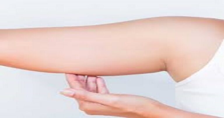 عملية شد الذراعين في الرياض