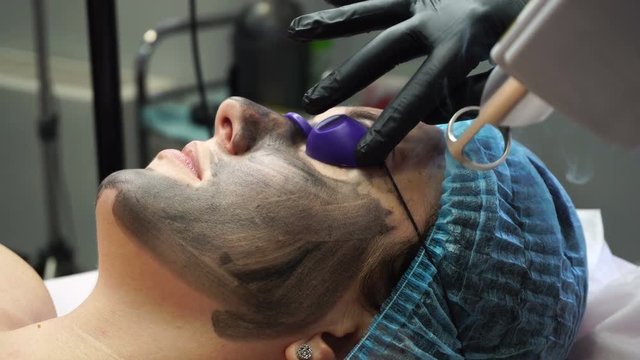 Carbon Facial in Islamabad
