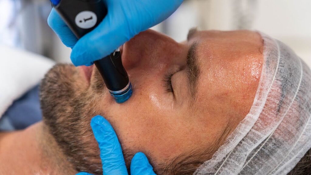 Male Hydrafacial In Islamabad