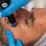 Male Hydrafacial In Islamabad
