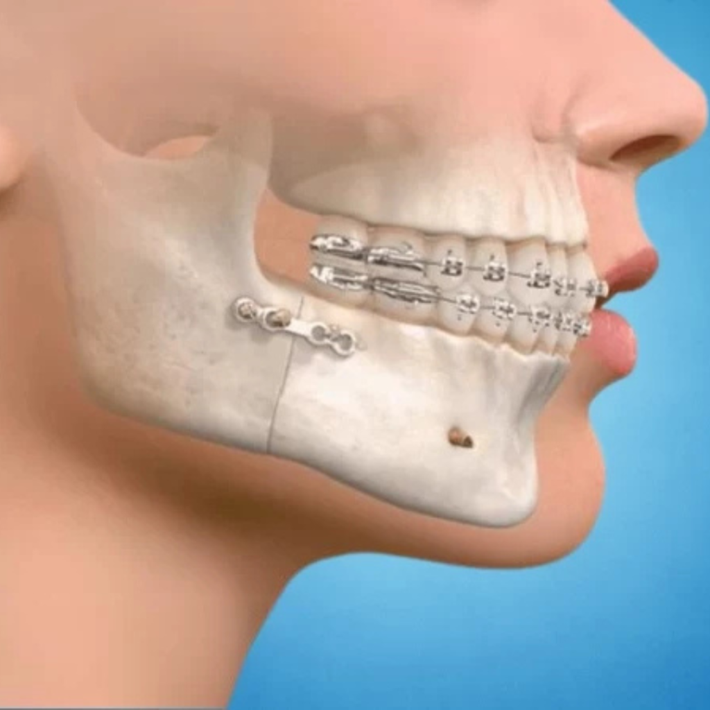 Maxillofacial-Surgery-1