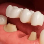 Untitled-design-2025-06-14T142641.842