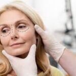 Blepharoplasty Dubai