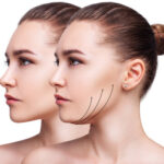 Best Skin Tightening Treatments for Face in Islamabad