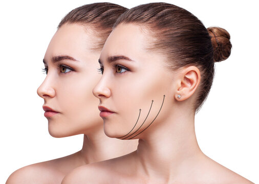 Best Skin Tightening Treatments for Face in Islamabad