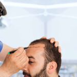 Hair Transplant in Riyadh