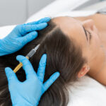 Microneedling Treatment – Natural Hair Regrowth at Cozmetika Clinics