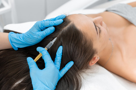 Microneedling Treatment – Natural Hair Regrowth at Cozmetika Clinics
