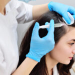 PRP Therapy for Hair Growth | Cozmetika Clinics