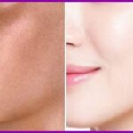 Skin Whitening Injections in Islamabad