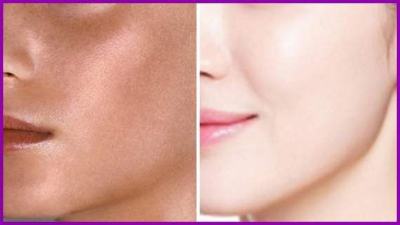 Skin Whitening Injections in Islamabad