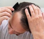 mature-man-having-balding-problems-1024x683