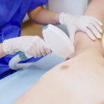 Armpit Hair Removal in Islamabad.