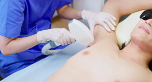 Armpit Hair Removal in Islamabad.