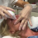 Best Skin Tightening Treatments for Face in Islamabad