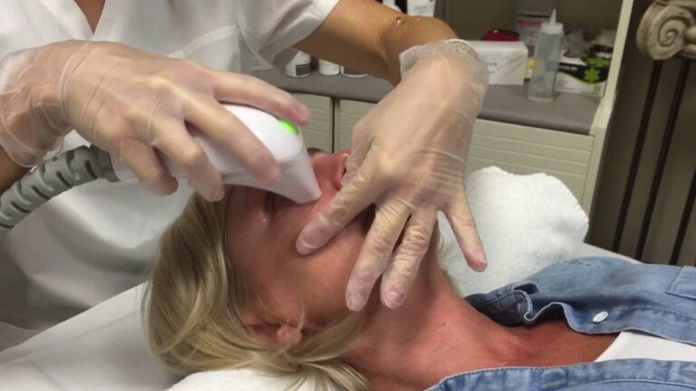 Best Skin Tightening Treatments for Face in Islamabad