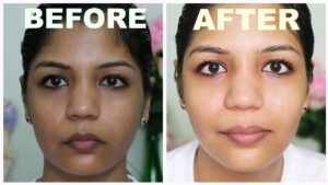 Does Glutathione Lighten Dark Spots