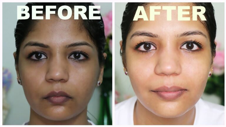 Does Glutathione Lighten Dark Spots