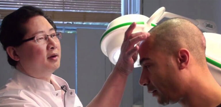 زراعة الشعر في دبي