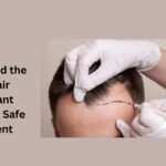 hair restoration doctor